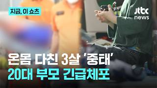 온몸 다친 3살 아이 병원 실려와‥.경찰, 20대 부모 긴급체포｜지금 이 쇼츠