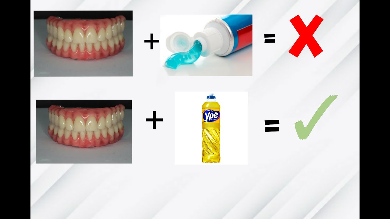 Limpeza da prótese dentária,passo a passo !