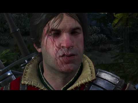 The Witcher 3: Wild Hunt - Kaer Morhen: To Bait a Forktail