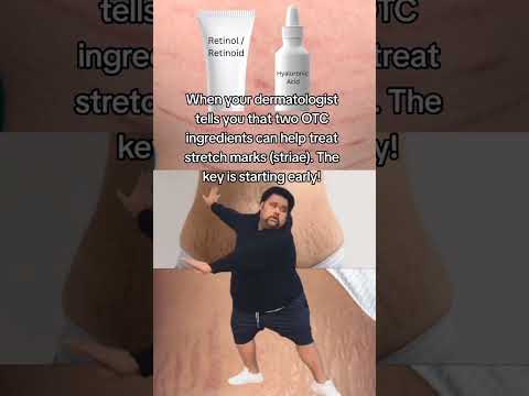 DERM HACK FOR STRECH MARKS? Here's two Derm Approved products that have proven to help (not biooil)