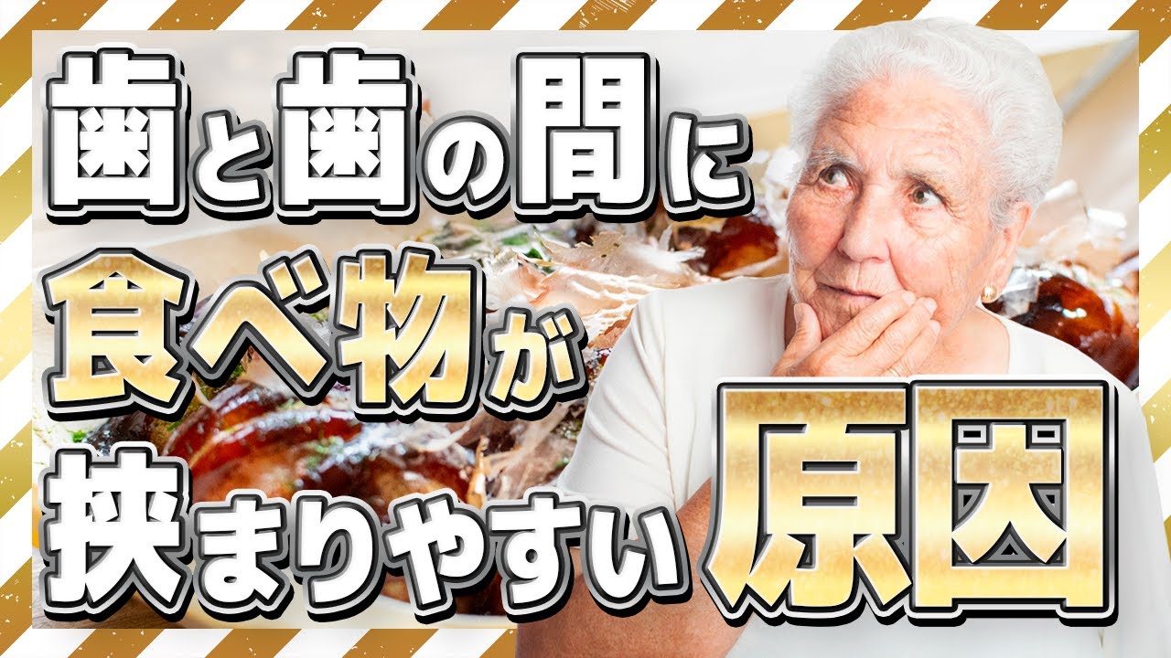【むし歯かも?】歯と歯の間に食べ物が挟まりやすい原因