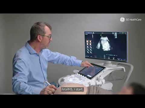 How to facilitate fetal heart scans to detect anomalies more easily? 