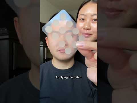 SKIN TAG ACNE PATCH DOTS,SKIN TAG ACNE PATCH DOTS Hydrocolloid Dressing Cover, Dots 20gm