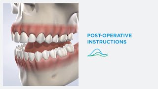 Post-Operative Instructions for Oral Surgery in Norton Shores, MI