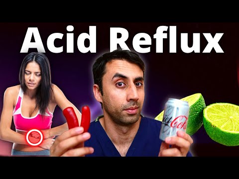 Avoid THESE Food If You Have Heartburn | Acid Reflux | GERD