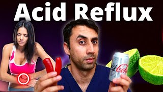 Avoid THESE Food If You Have Heartburn | Acid Reflux | GERD