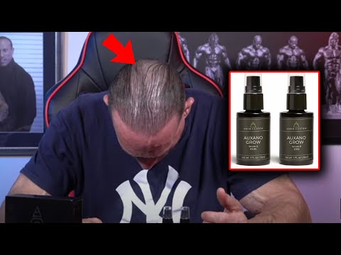 The Product Helping Dave Re-Grow Hair | Aseir Custom Review