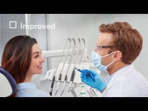 Филтек Балк Филл, А1, жидкотекучий композитный материал, 2г (3M ESPE) - фото 1 - id-p2808009858