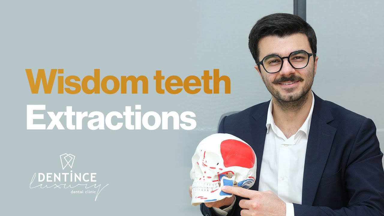 Wisdom Teeth Extractions
