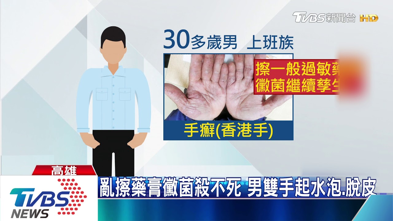 富貴手擦藥沒效？　醫師看傻「這治香港腳的」