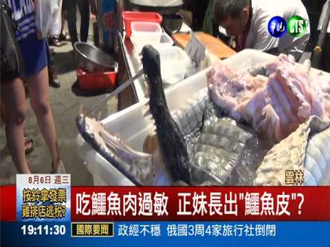 吃鱷魚肉過敏 正妹長出"鱷魚皮"?