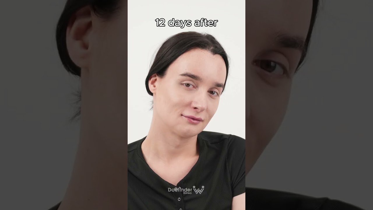 FFS in South Korea - Final Results