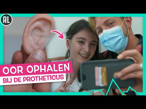 NIEUW OOR VOOR ESTRELLA👂🏼✨- TOPDOKS SPECIALISME