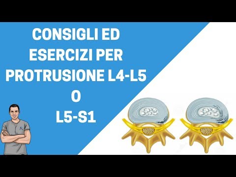 Ortesi linguette sulla spalla Protrusione della colonna vertebrale e il suo trattamento di rimedi popolari.