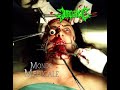 💀 Impaled - Mondo Medicale (2002) [Full Album] 💀