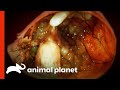 Huge Ovarian Tumour Had Teeth And Hair | Monsters Inside Me
