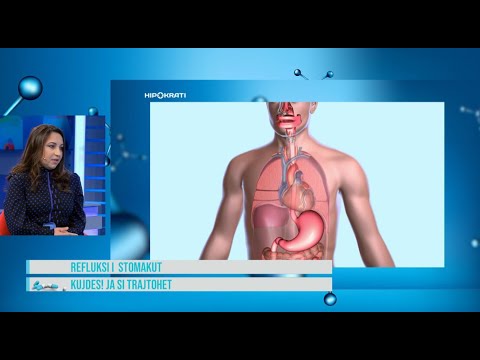 Hipokrati - Si ta kuroni refluksin e stomakut! Këto tri pije shkatërrojnë thartirën në stomak