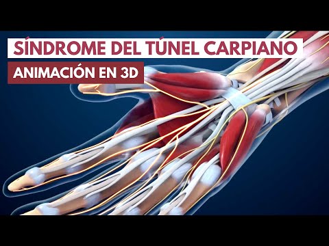 Síndrome del túnel carpiano | Animación en 3D