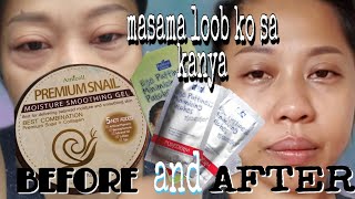 HOW TO GET RID OF EYEBAGS AFTER CRYING AT NIGHT