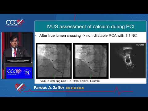 IVUS OCT  Optimizing Complex PCI, A MUST! - Farouc A Jaffer, MD