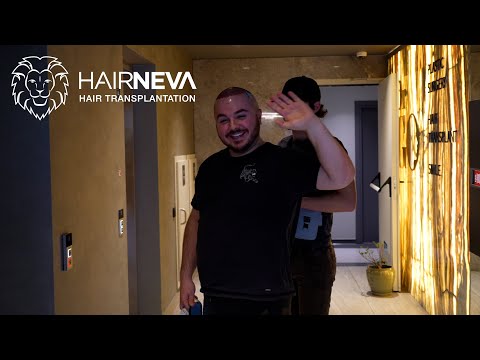 🌟 WITNESS THE COMPLETE HAIR RESTORATION JOURNEY! 🌟