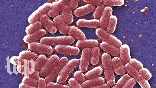 E coli infections are gross Here are 5 facts you can t unlearn about them Mp4 3GP & Mp3