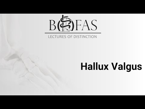 Hallux Valgus - BOFAS Lectures of Distinction