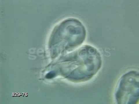 Come purgare un organismo da parassiti Parassiti a pesci di stagno