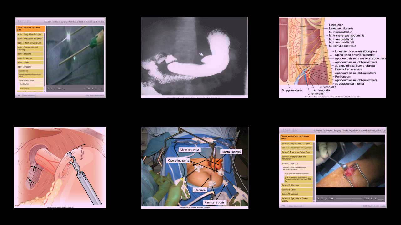 SABISTON. Tratado de cirugía