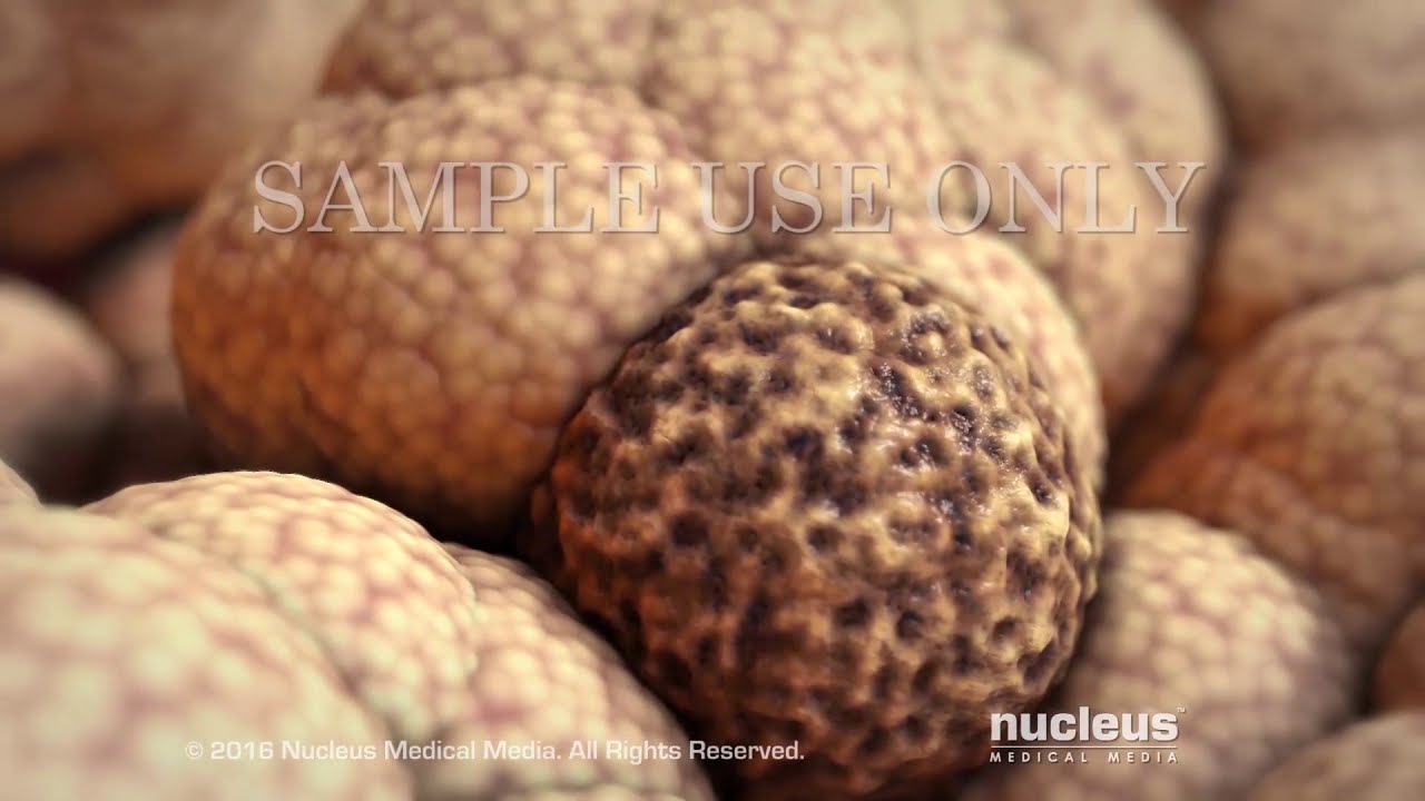 Roberto Carlos Castañeda Caballero-21