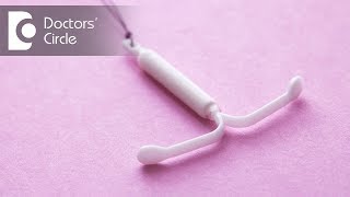 When should IUD be removed, before or after periods? - Dr. Shefali Tyagi