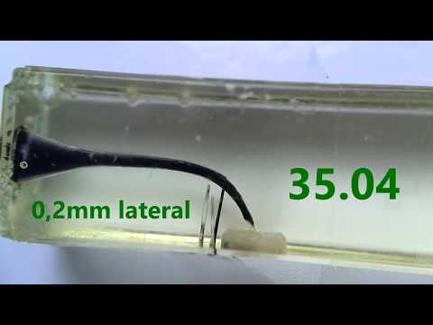 Ultrasonic vs Endoactivator vs VDW EDDY