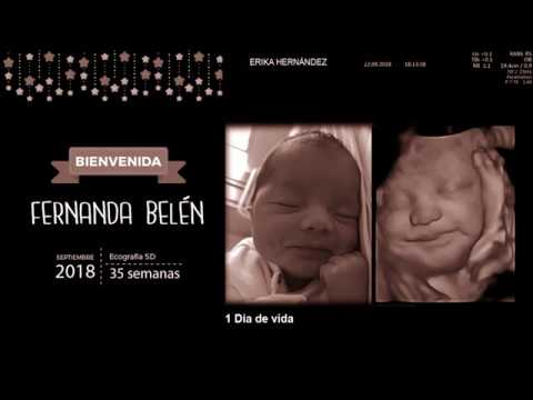 Imagenes de ecografias de 35 semanas de embarazo
