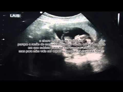 Érrej - No Escuro (brevemente mixtape "pedras da calçada")