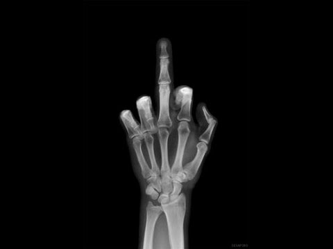 BiG WoLF Ft BonSaTon - Lypim RivaL