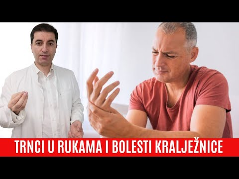 Kada TRNJENJE, ŽARENJE I PECKANJE u RUKAMA znači da imate bolesnu KRALJEŽNICU? I koje je riješenje?
