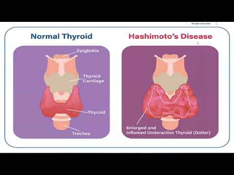 2025 PAoBio Sci. Days | Rec03 |  Cytogenetic Analysis & Hashimoto's Thyroiditis | Dr. Saja Shareef