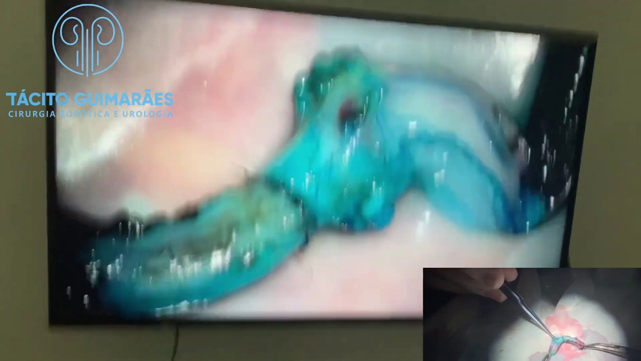 Tácito Guimarães-10