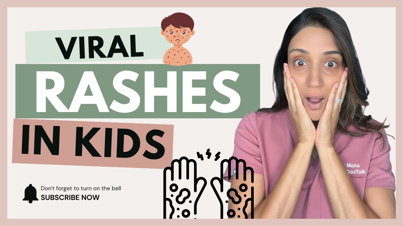 Pediatrician Explains Viral Rashes and Fifth Disease and Sixth Disease (Roseola)