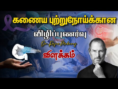 Pancreatic Cancer Risk Factors - GEM Cancer Centre