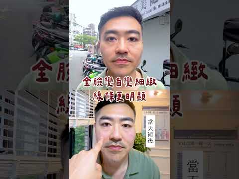 北秀醫美短影音 3