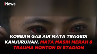 Download lagu Korban Gas Air Mata Tragedi Kanjuruhan, Mata Masih Merah & Trauma Nonton di Stadion #iNewsPagi 11/10 mp3 Download lagu Korban Gas Air Mata Tragedi Kanjuruhan, Mata Masih Merah & Trauma Nonton di Stadion #iNewsPagi 11/10 mp3