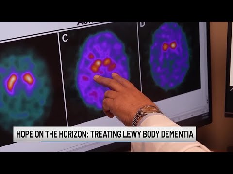 Hope on the horizon: Treating Lewy Body dementia