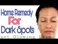 Say GoodBye To Dark Spots On Your Face At Home With These Tips and Tricks|for men/women