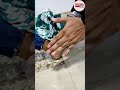 पैर मे आई मोच तुरंत करें ये उपाय मिलेग�