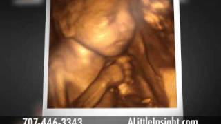 preview picture of video 'Little Insight 3D4D Ultrasound Review Bay Area Sacramento Fairfield Vacaville Vallejo Napa Concord'