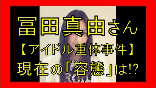 冨田真由 容態 目は回復するのか 刺された箇所は顔だった 意識回復も 重体アイドル تنزيل الموسيقى Mp3 مجانا