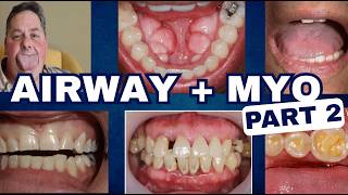 PART 2 of Implementing Sleep, Airway and Myo to Restorative Dentistry - PDP263