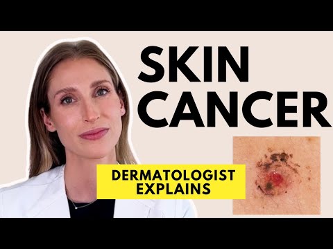 Dermatologist Explains Skin Cancer: Different Types, Causes, Prevention & Treatments | Dr. Sam Ellis