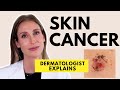 Skin Cancer: Different Types, Causes, Prevention & Treatments | Dr. Sam Ellis